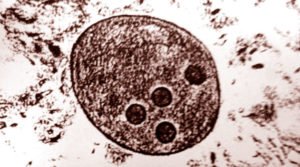Entamoeba histolytica