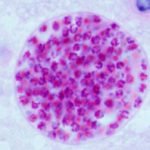 Toxoplasmose: Toxoplasma gondii
