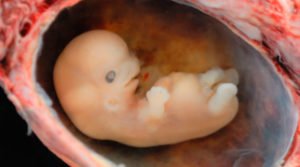 Ontogenia - Embrião humano