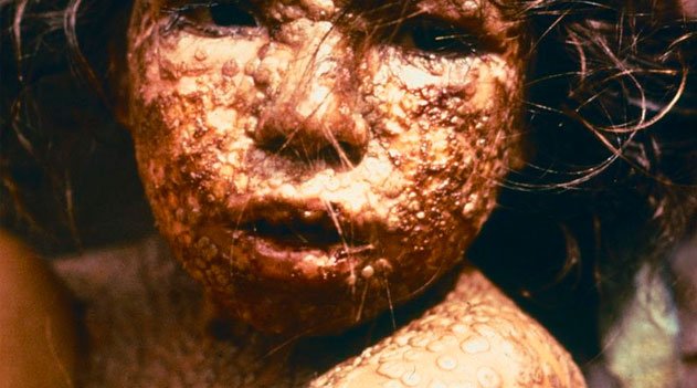 Documentário Imunologia