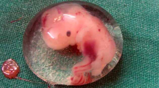 Embriologia humana - embrião humano