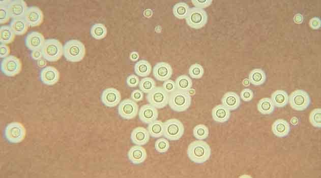 Fungos patogênicos - Cryptococcus neoformans